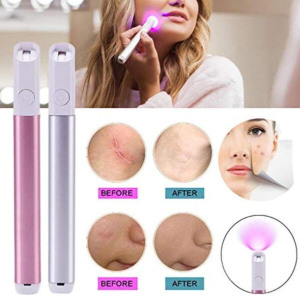 ⁦جهاز العلاج الضوئي Yimili YML180 تخلص من حب الشباب بسرعة وسهولة⁩ - الصورة ⁦3⁩